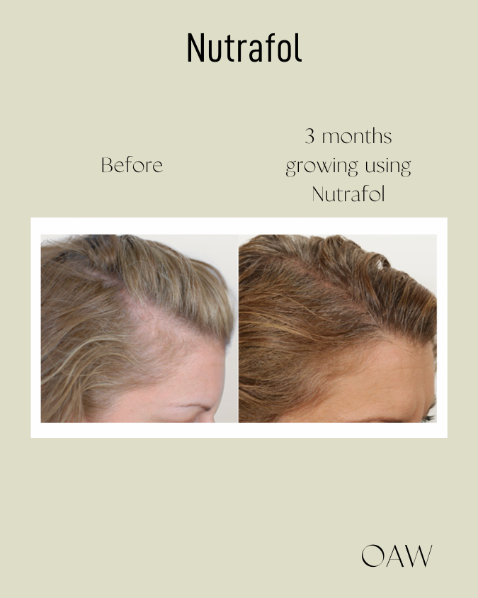 Crecimiento del cabello de las mujeres desde dentro